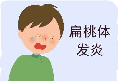 扁桃体发炎也会引起宝宝频繁高烧