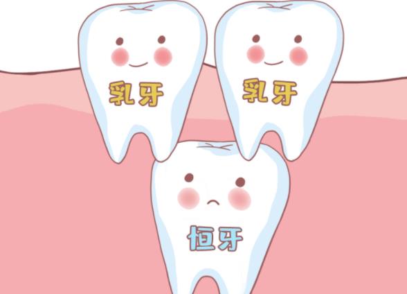 儿童换牙长歪了怎么办 5-12岁及时矫正 对症治疗