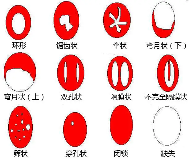 火遍国外的卫生棉条到底有哪些好处？如何放进体里？手把手教你