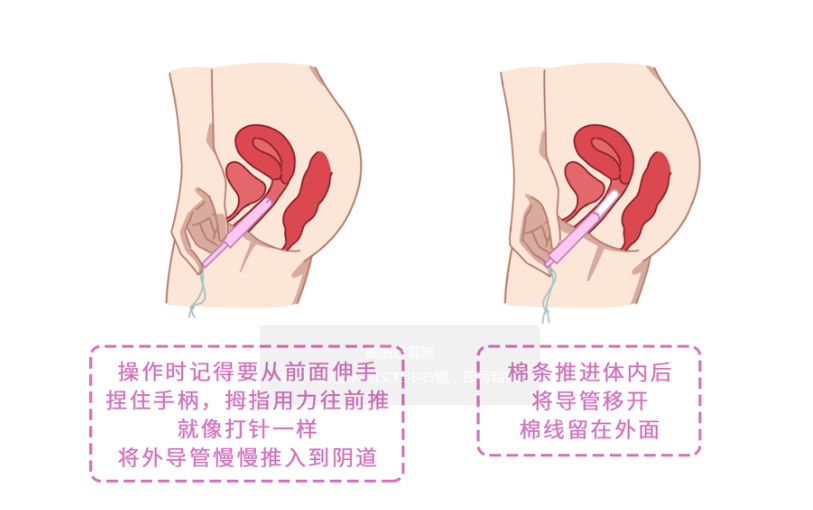 火遍国外的卫生棉条到底有哪些好处？如何放进体里？手把手教你