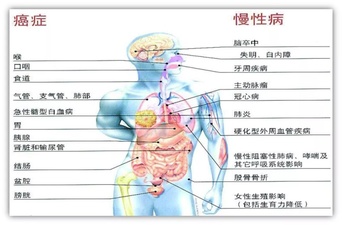 抽烟、喝酒和喝茶，哪个对身体伤害最大？医生告诉你真相