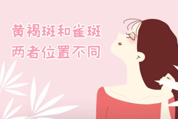 黄褐斑与雀斑的区别有哪些？